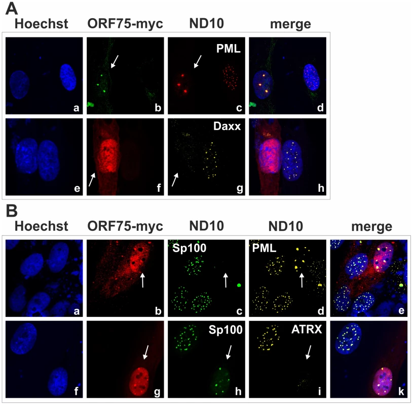 KSHV ORF75 is sufficient for antagonization of ATRX and Sp100.