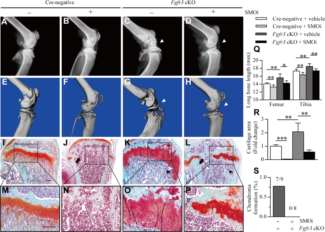 Inhibition of IHH signaling suppresses growth plate expansion and the formation of chondroma-like lesions in <i>Fgfr3</i> cKO mice.