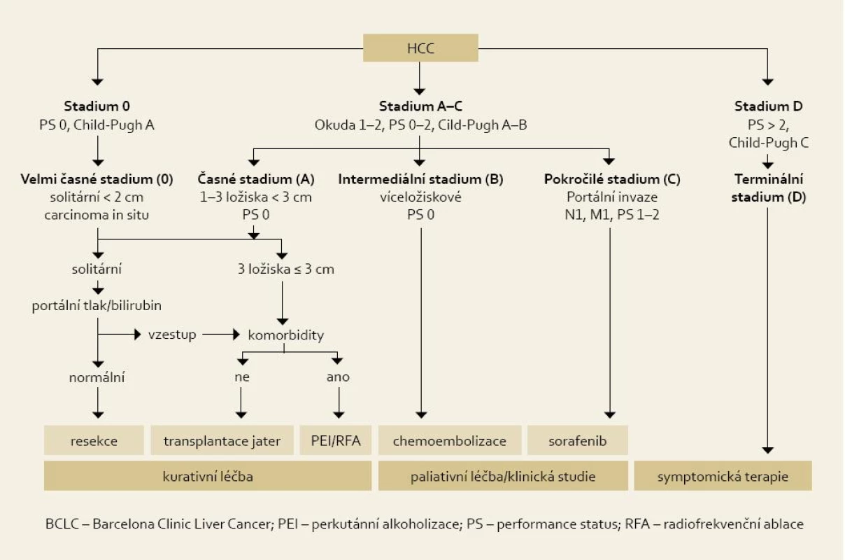 Algoritmus léčby HCC podle klasifikace BCLC.
Fig. 1. Algorithm of HCC treatment according to BCLC classification.
