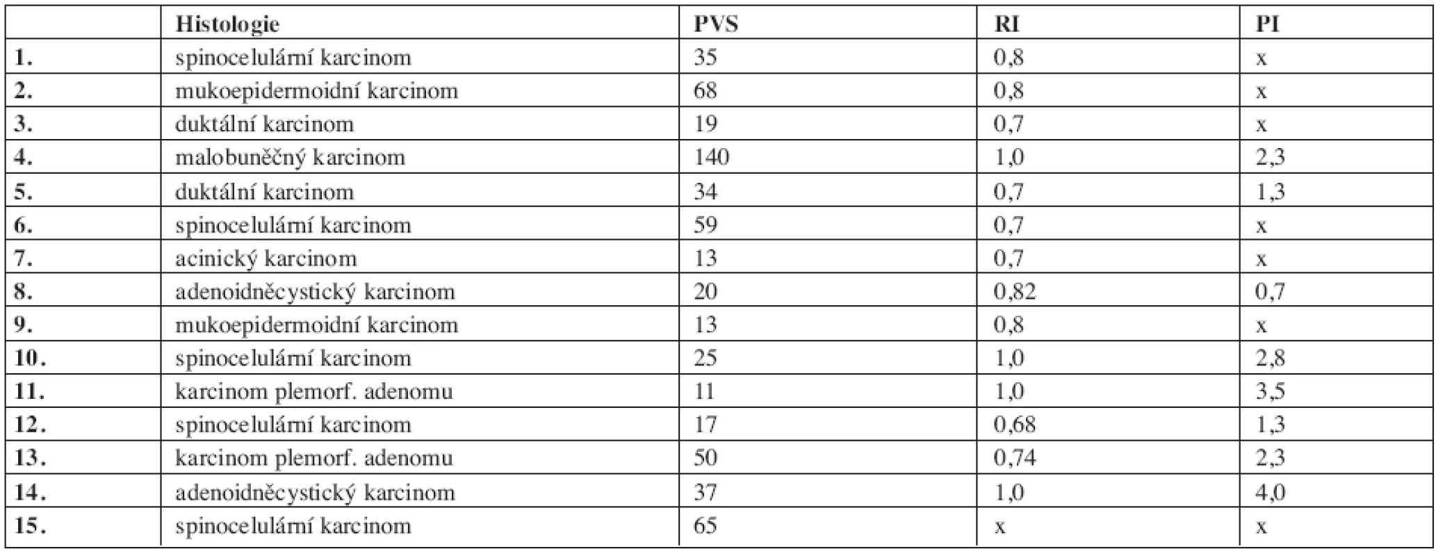 Srovnání výsledků histologického vyšetření maligních nádorů s hodnotami PSV, RI a PI.