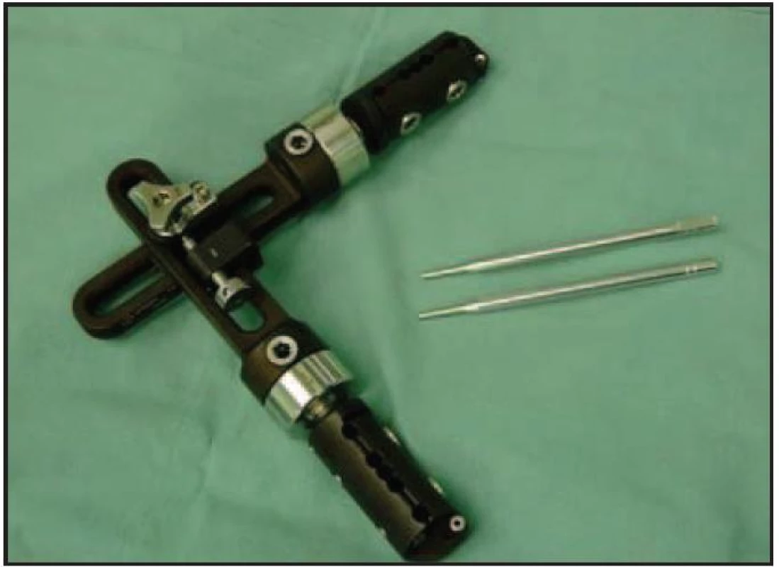 Elbow Unilateral Hinged Fixator (Orthofix)