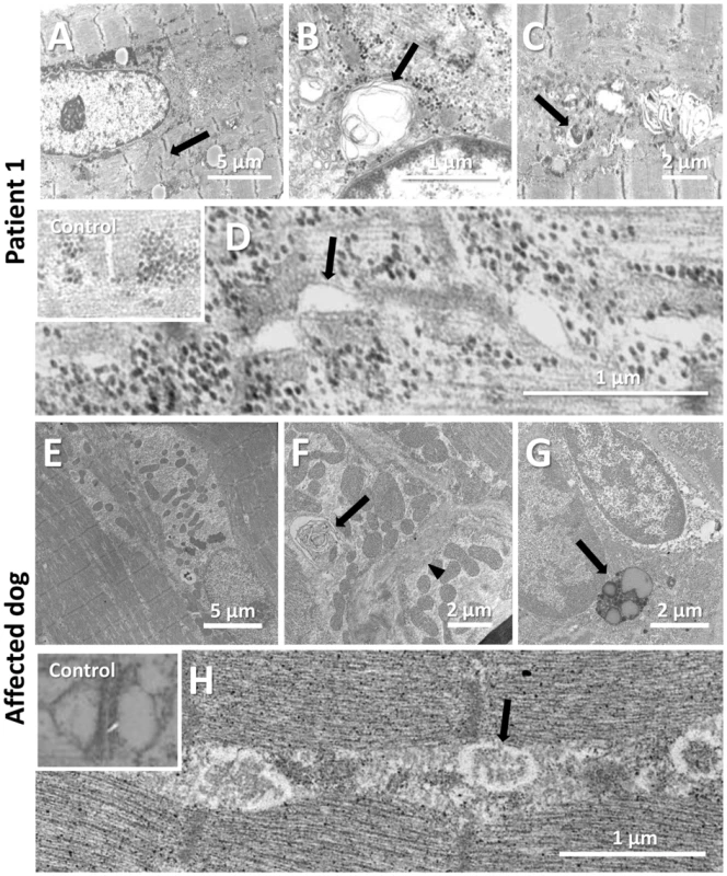 Common ultrastructural and membrane defects in affected human and dog.