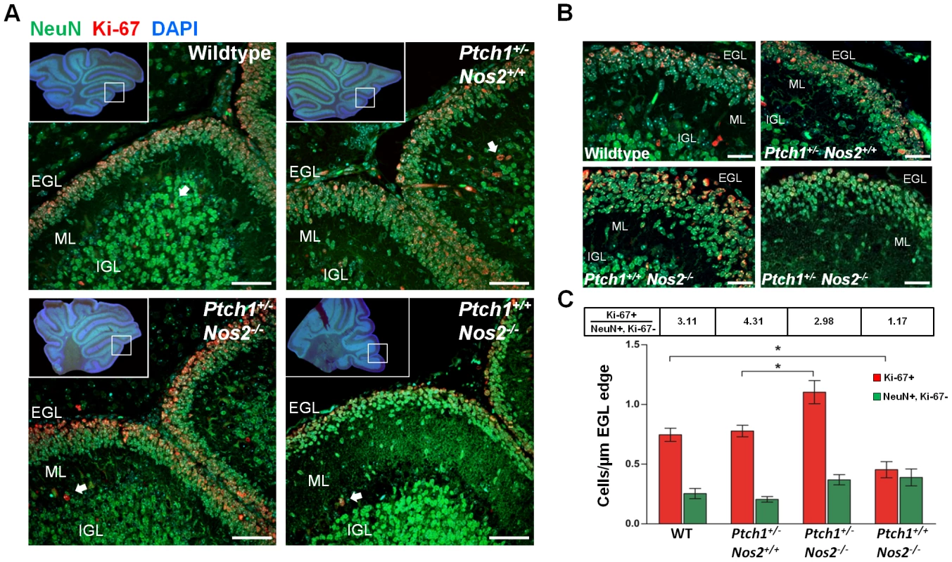 Proliferation and accumulation of GCPs in postnatal cerebellum.