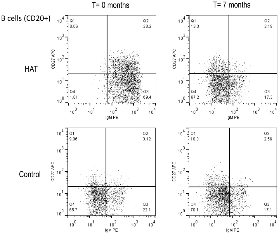 Flow cytometry dot plot of the CD20+ B-cell population in HAT and in a control.