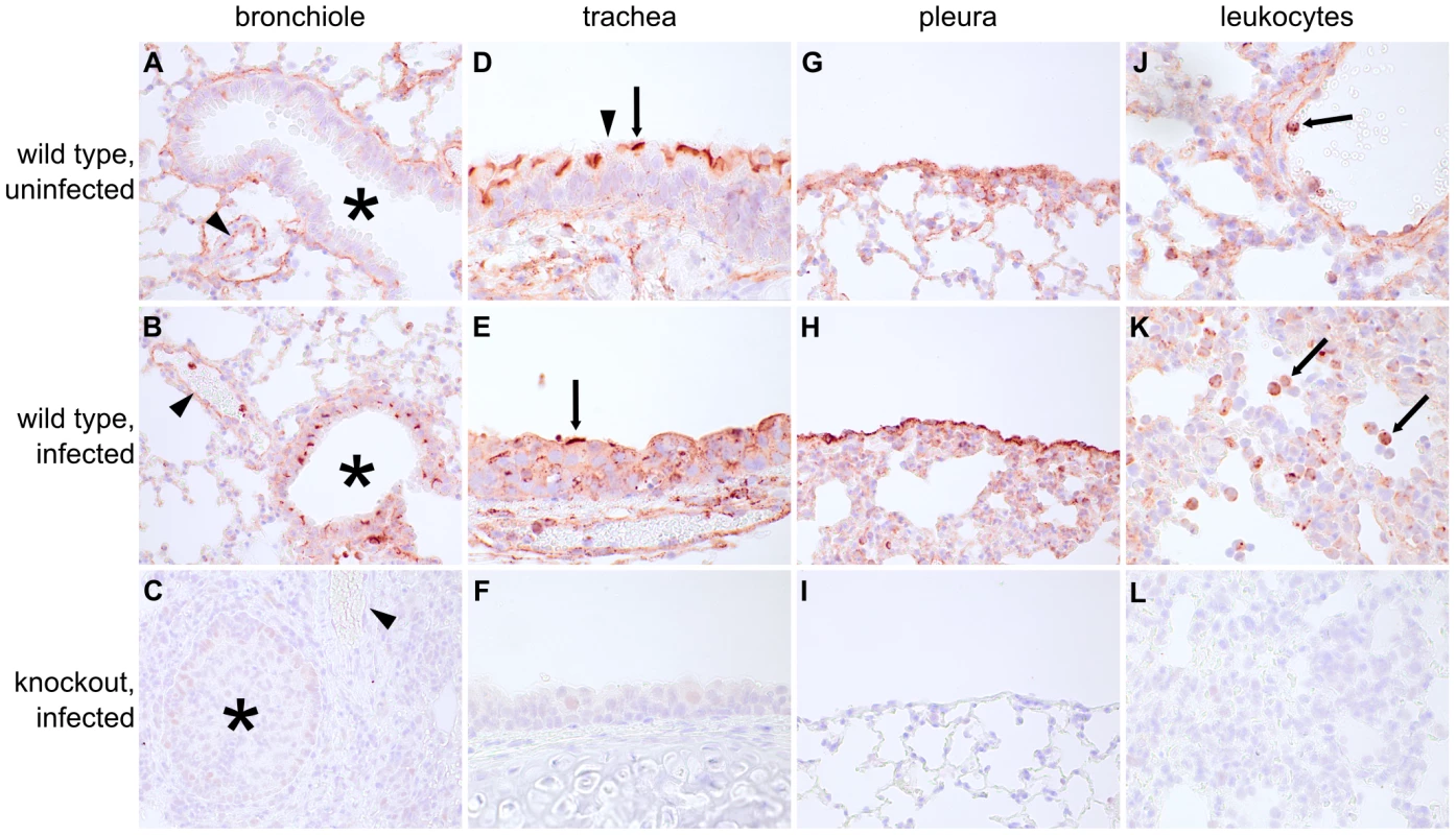 Ifitm3 is constitutively expressed by many respiratory tissues and induced in lower airway epithelium by influenza.