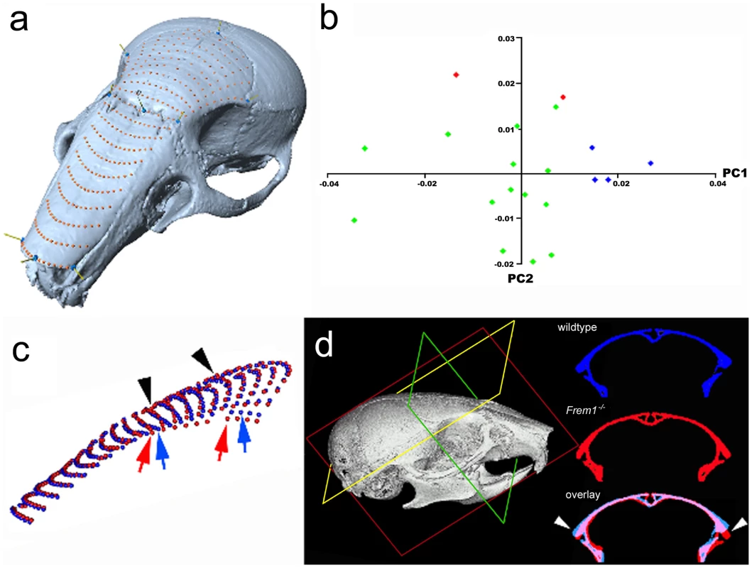Frem1 mCT and morphometric analysis in mice are consistent with the human MC phenotype.
