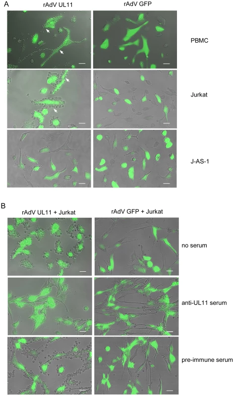 Surface expressed pUL11 mediates cell adhesion.