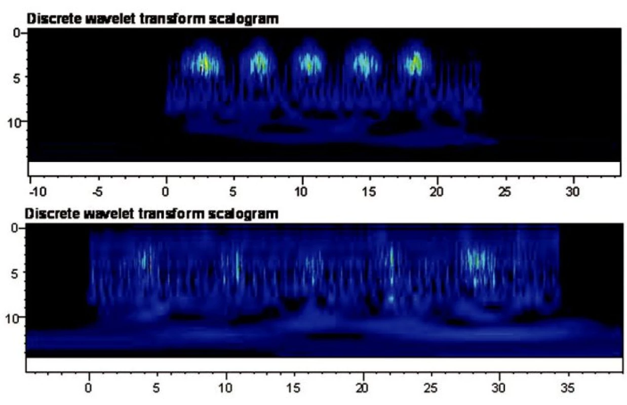 a) Výsledky - diskretní vlnková transformace pro m. latissimus dorsi režim na suchu.
b) Výsledky - diskretní vlnková transformace pro m. latissimus dorsi režim ve vodním prostřední.