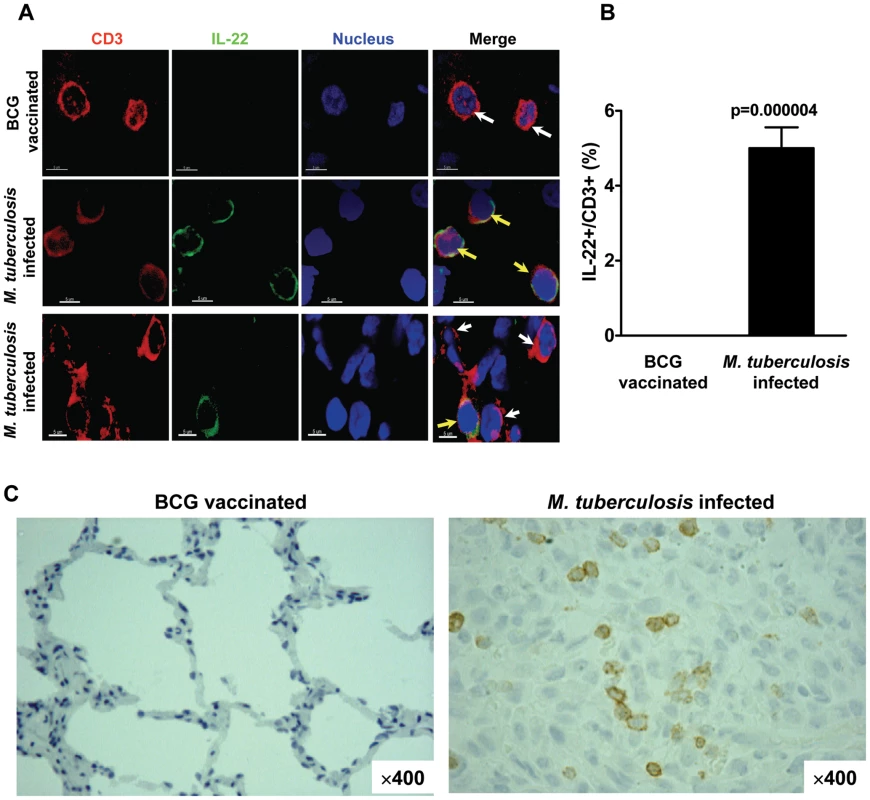 IL-22-producing T cells were detected <i>in situ</i> in lung TB granulomas from <i>M. tuberculosis</i> infected monkeys.