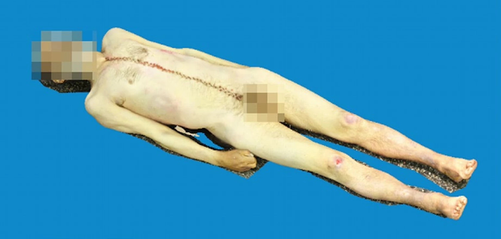 Fotogrammetrie