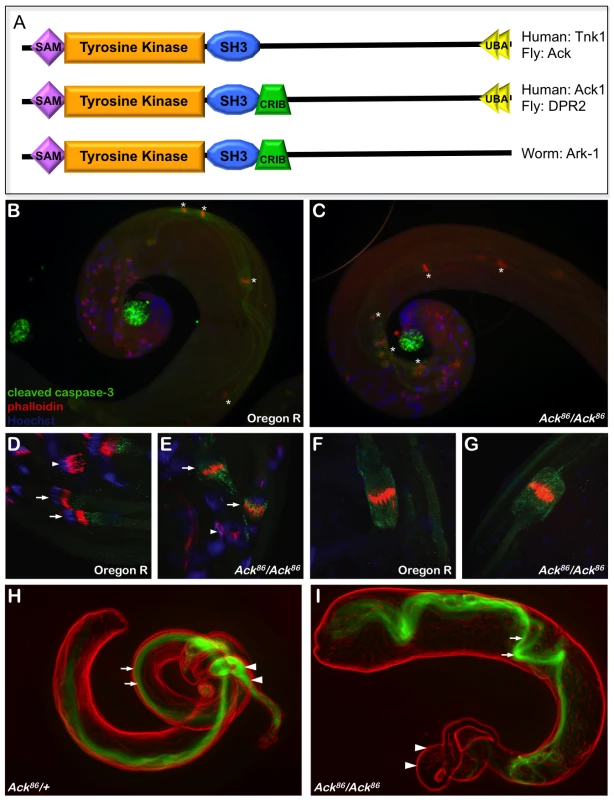 Ack is required for mature sperm production.
