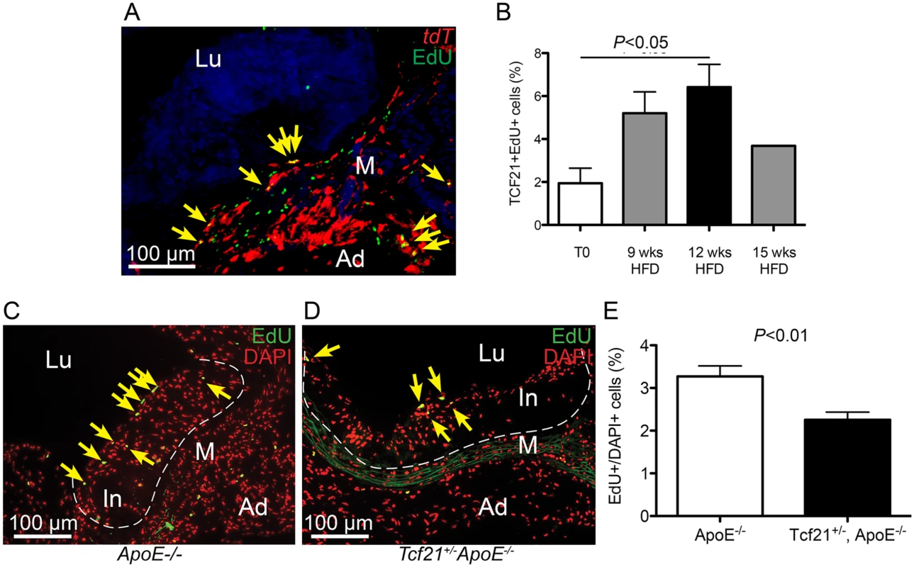 Rate of cell division in vascular lesions is related to Tcf21 expression.