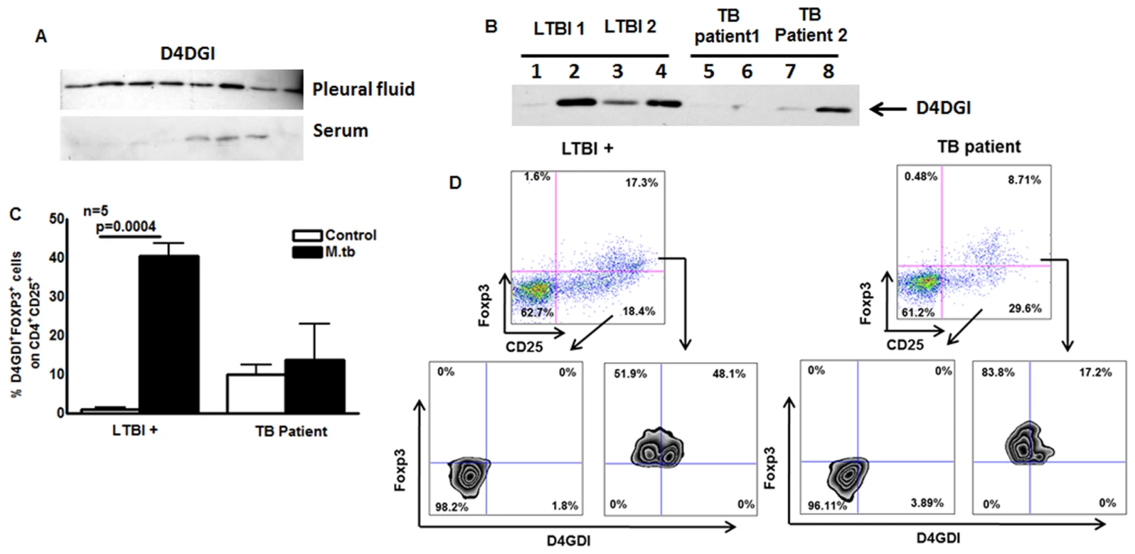 D4GDI expression by TB patients.