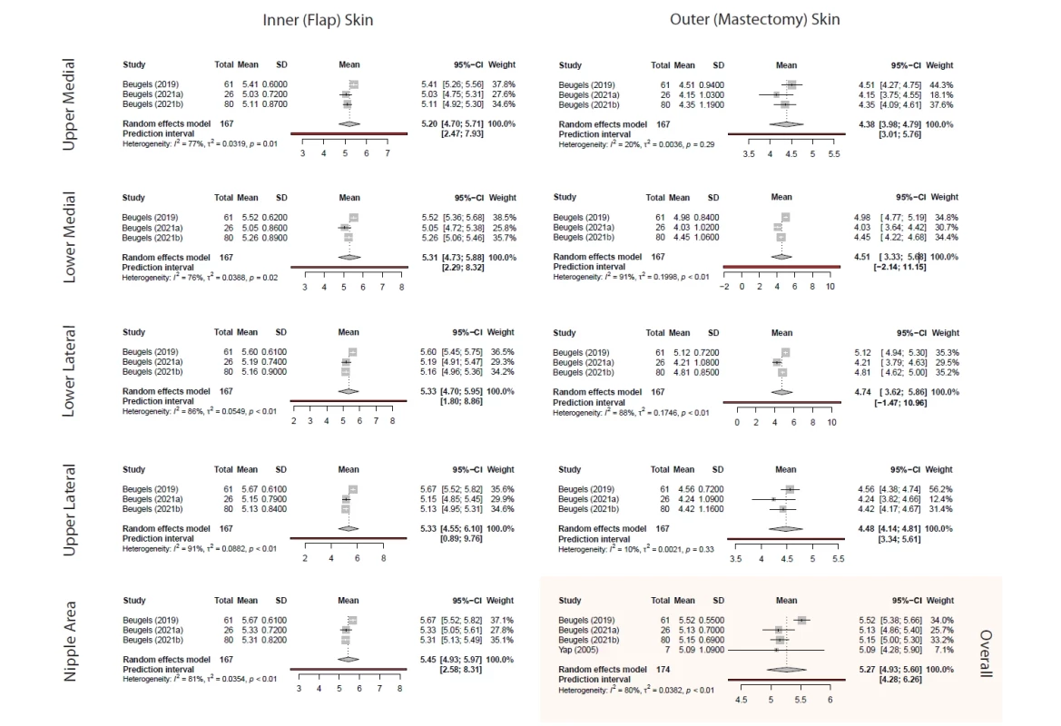 Forest plot for area-specifi c SMWT rod size in breasts without surgical reinnervation in 167 patients across three studies. Pooled SMWT rod size was generally lower in outer (mastectomy) skin: 4.38 (95% CI 3.98; 4.79) for upper medial, 4.51 (95% CI 3.33; 5.68) for lower medial, 4.74 (95% CI 3.62; 5.86) for lower lateral, and 4.48 (95% CI 4.14; 4.81) for upper lateral sections. Pooled SMWT rod size for inner (fl ap) skin was found to be 5.20 (95% CI 4.70; 5.71) for upper medial, 5.31 (95% CI 4.73; 5.88) for lower medial, 5.33 (95% CI 4.70; 5.95) for lower lateral, 5.33 (95% CI 4.55; 6.10) for upper lateral, and 5.45 (95% CI 4.93; 5.97) for nipple sections.