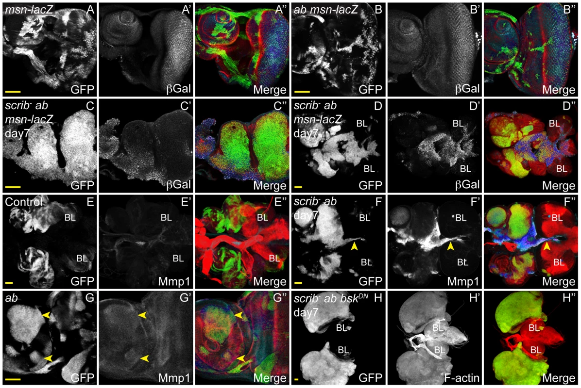 JNK signalling in <i>scrib<sup>−</sup></i>+<i>ab</i> tumours is required for invasion, but not tumour overgrowth.