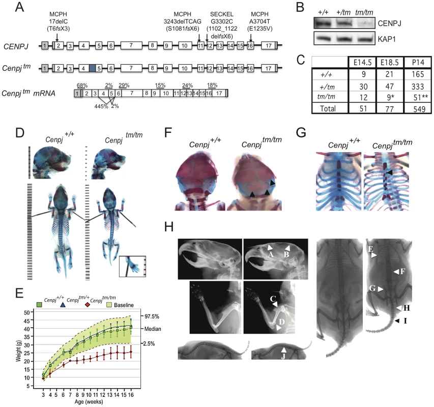 Generation of a mouse model of <i>CENPJ</i>-Seckel syndrome.