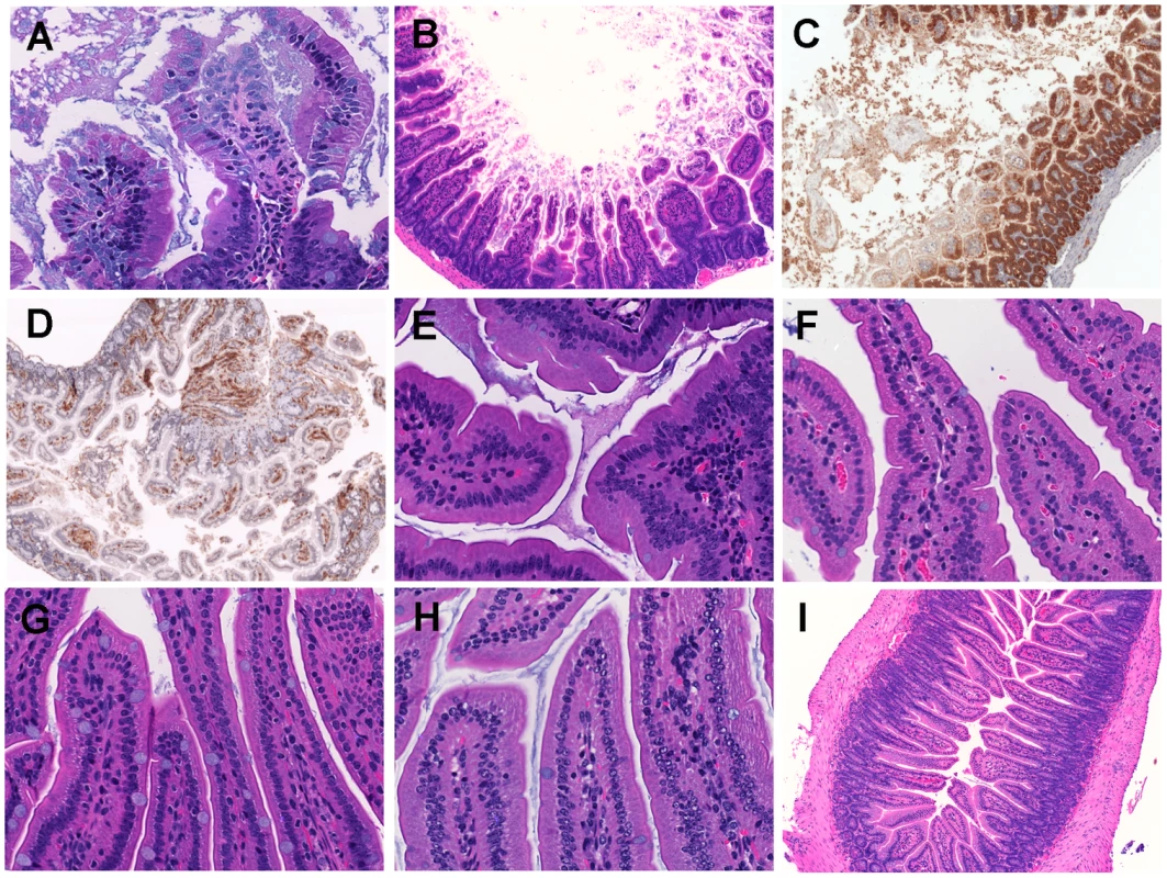 Histopathological examination of mice small intestine inoculated with <i>V. vulnificus</i> strains.