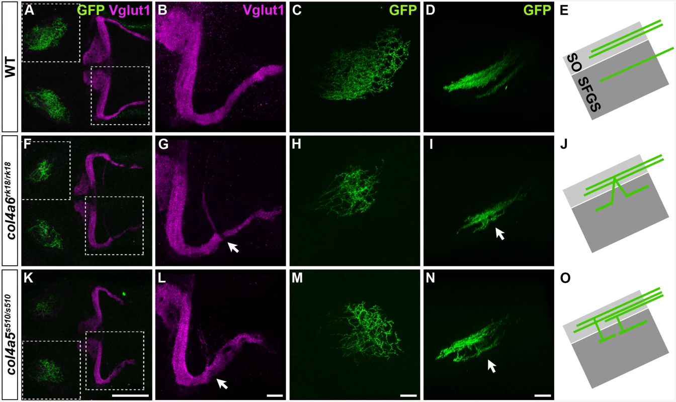 The Col4a5 and Col4a6 complex plays a role in the axogenesis of GCs and RGCs.