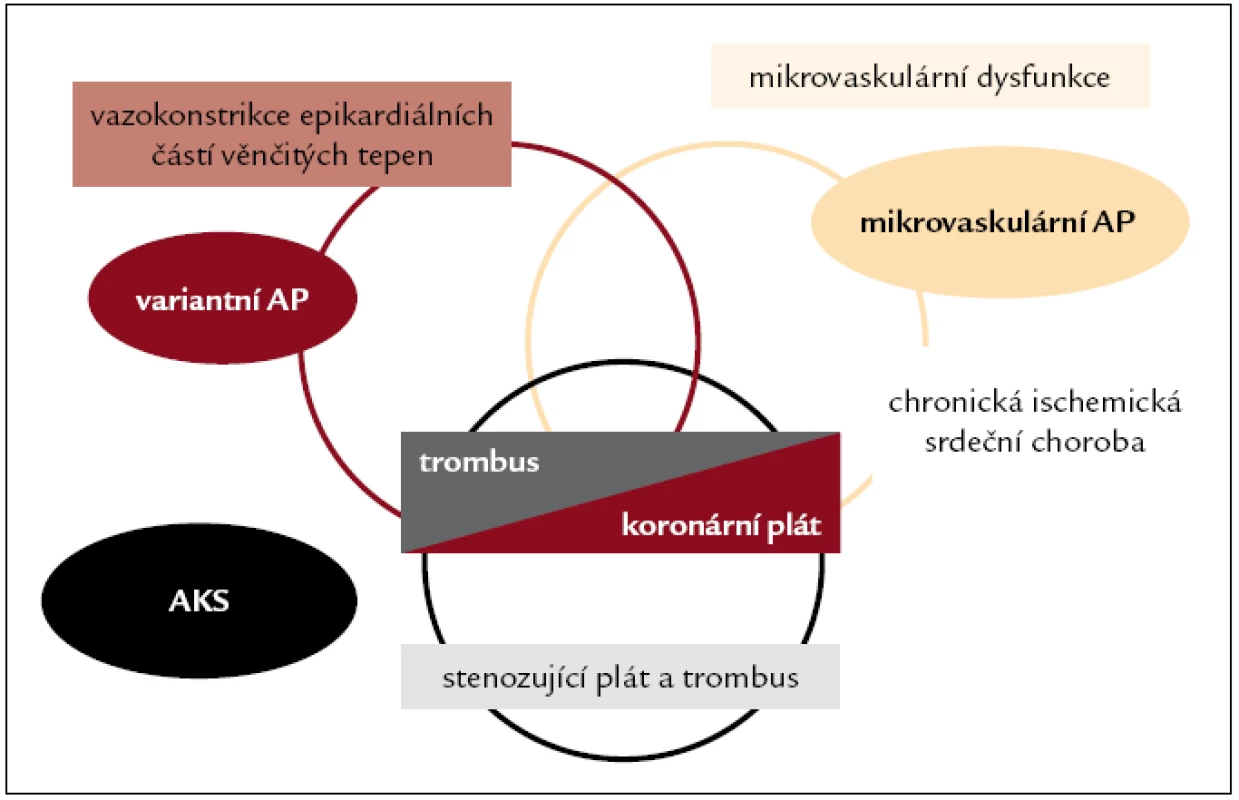 Patofyziologické mechanizmy a klinická prezentace různých forem ischemické srdeční choroby.