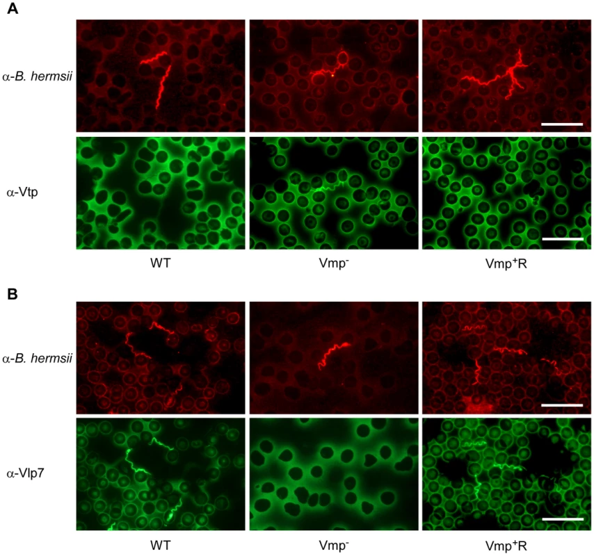 The Vmp<sup>−</sup> mutant <i>B. hermsii</i> produces Vtp during its spirochetemia.