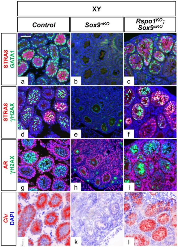 Sertoli cells support germ cell differentiation in XY <i>Rspo1<sup>KO</sup>Sox9<sup>cKO</sup></i> gonads.