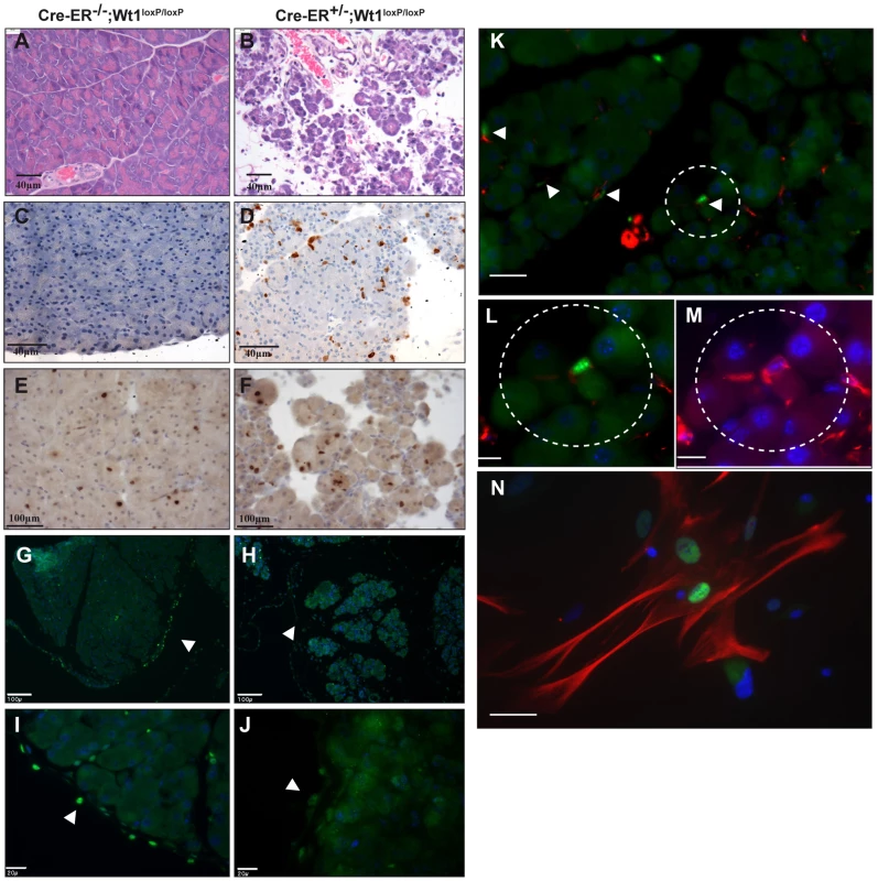 Deletion of <i>Wt1</i> leads to atrophy in the exocrine pancreas.