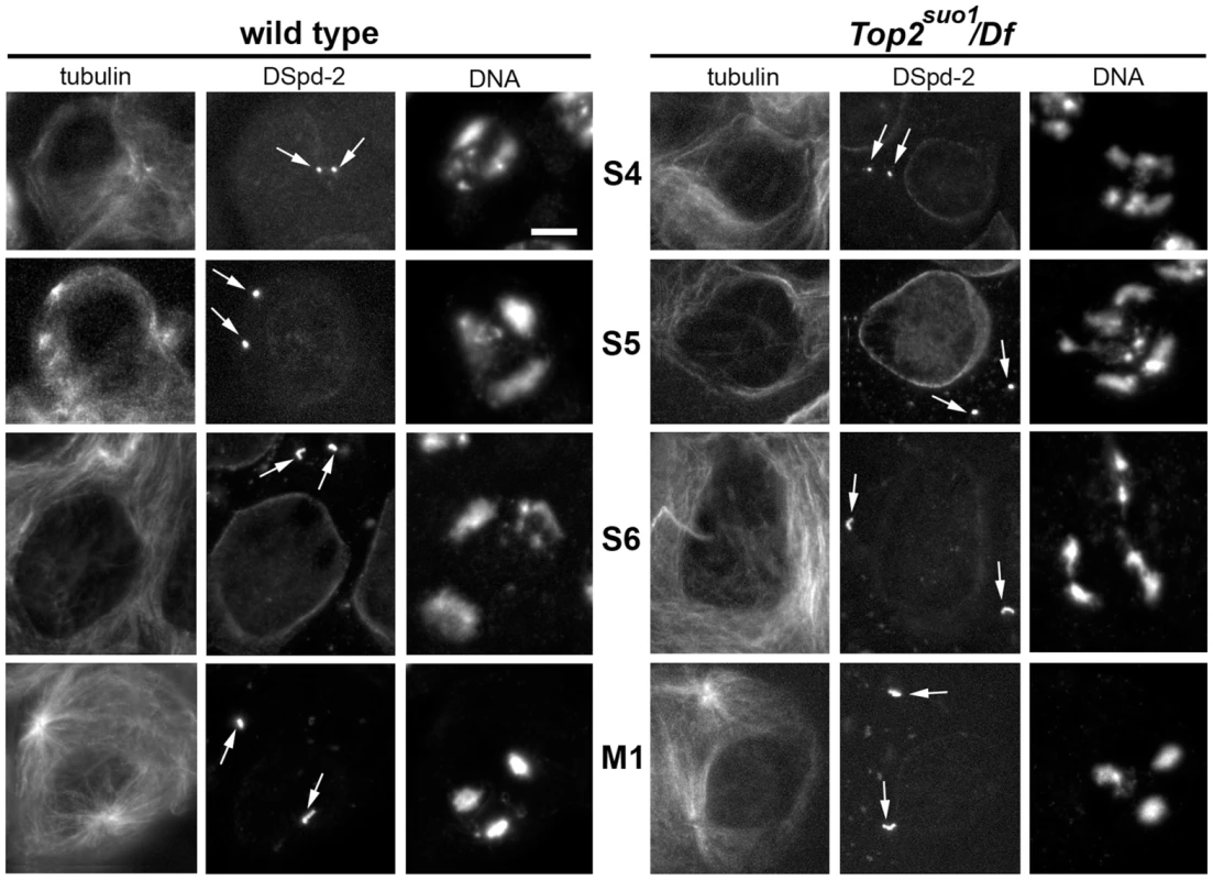 <i>Top2<sup>suo1</sup>/Df</i> spermatocytes exhibit an abnormal chromatin distribution within the prophase nuclei.