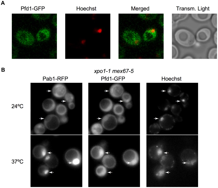 Prefoldin localizes to the nucleus.