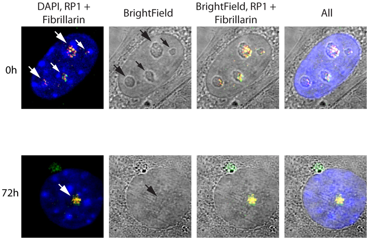 Somatic Nucleolar Precursor Bodies are distinguished from nucleoli by not being visible in bright field.