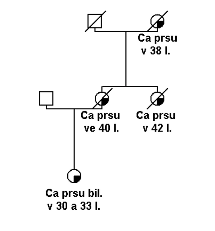 Rodina s vysokou pravděpodobností hereditárního syndromu nádorů prsu. Zjištěna pouze varianta s neznámým klinickým účinkem v genu BRCA1 (UV).