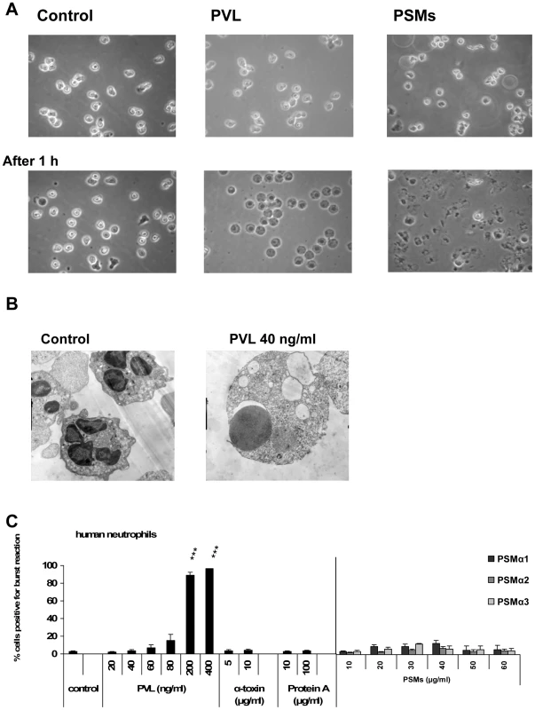 Differences between PVL- and PSMs-induced cell death.