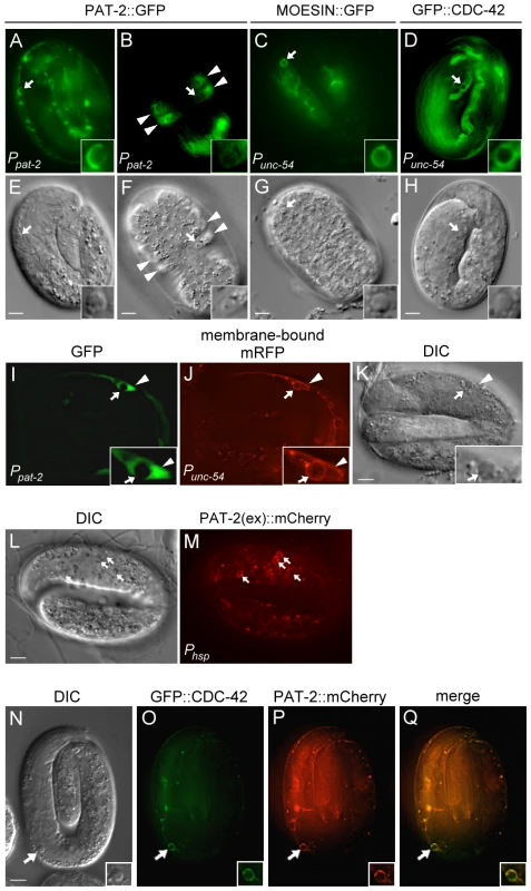 PAT-2 is strongly expressed in muscle cells and clusters around apoptotic cells.