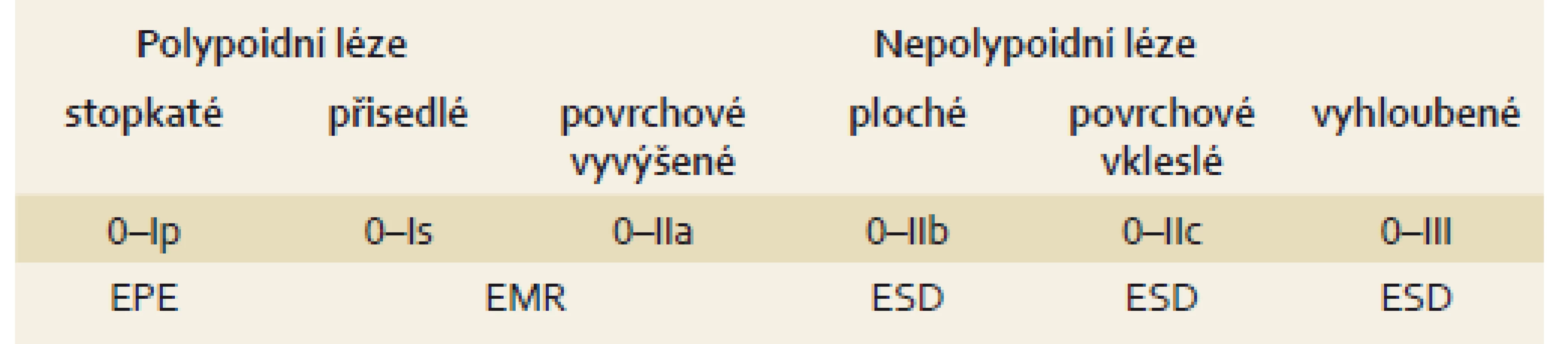 Indikace k endoskopické resekci podle morfologického vzhledu léze [24].
Tab. 4. Indications for endoscopic resection according to the endoscopic appearance of the lesion [24].