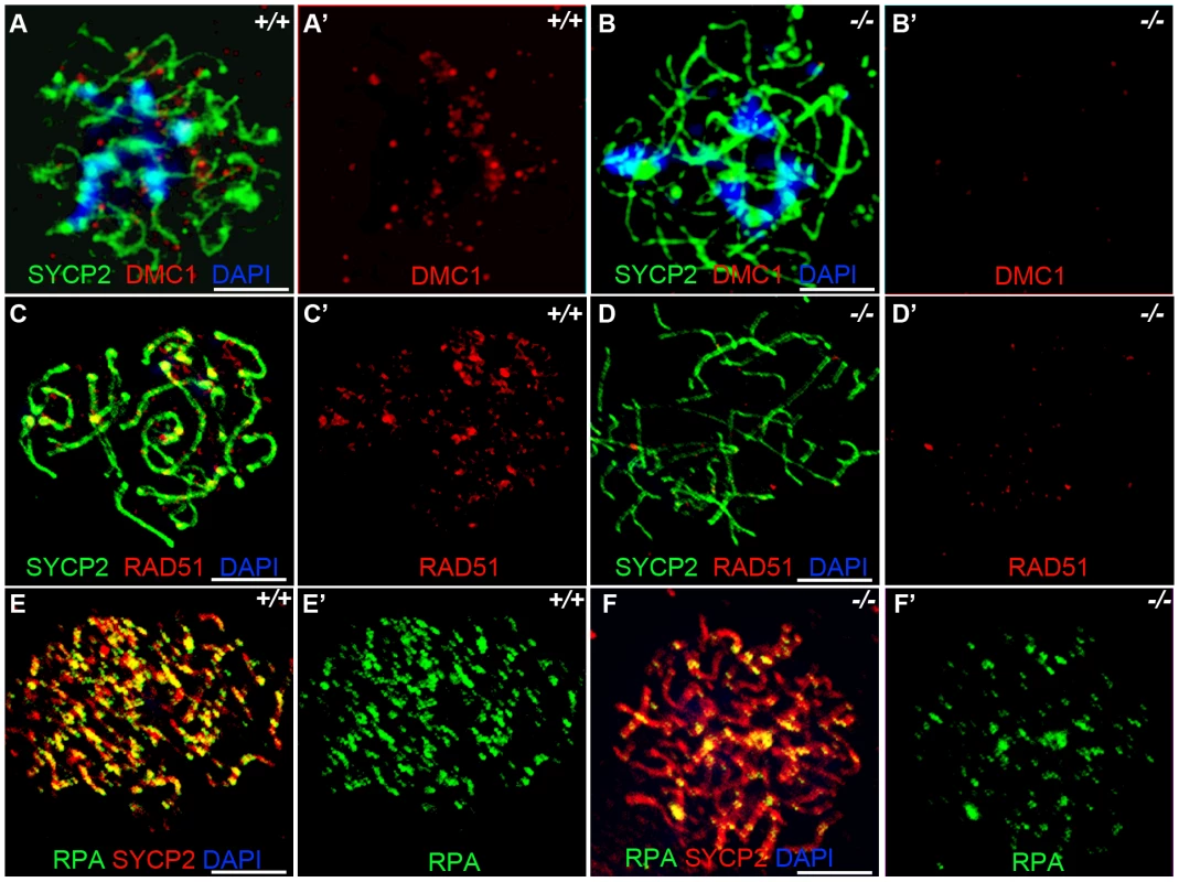 <i>Hormad <sup>−/−</sup></i> spermatocytes are defective in early recombination.