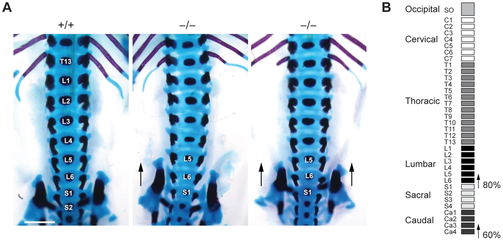 Skeletal transformations in Jarid1b knockout embryos.
