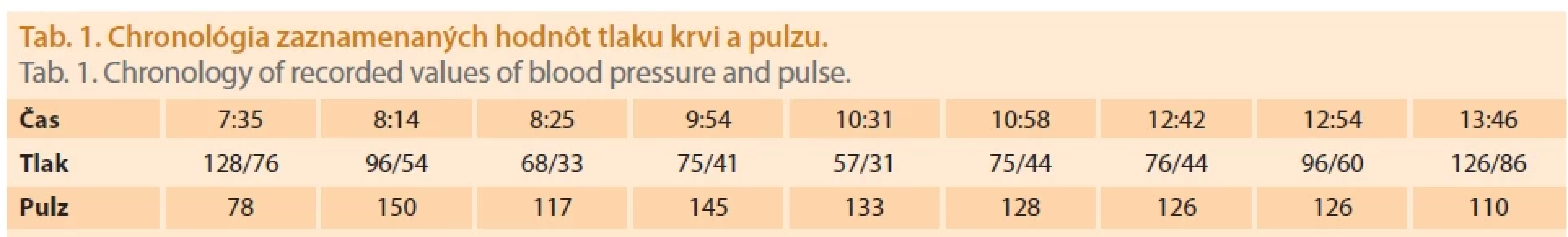 Chronológia zaznamenaných hodnôt tlaku krvi a pulzu.