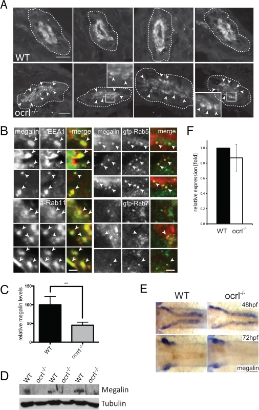 Megalin transcript and protein analysis in OCRL1-deficient zebrafish embryos.