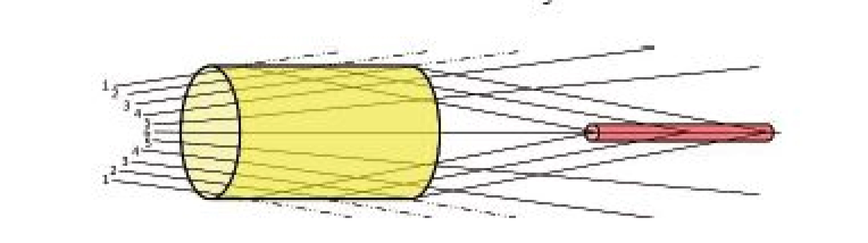 Hypothesis explaining focusing of ultrasound energy.