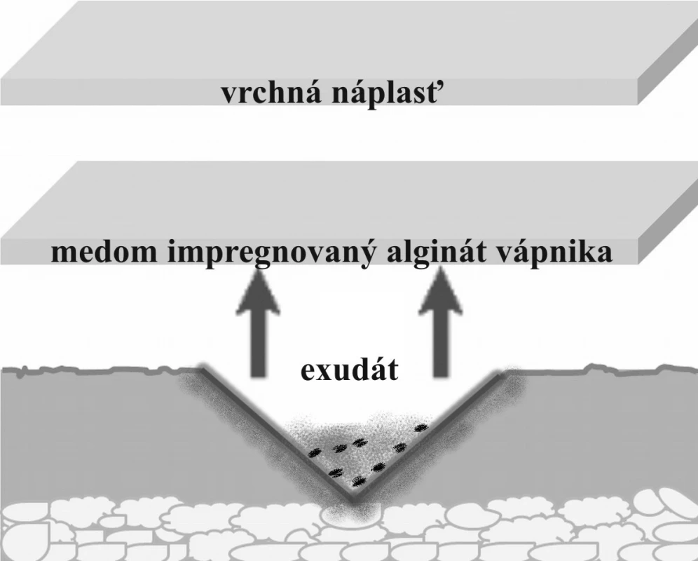 Medom impregnovaný alginátový nosič predlžuje dobu pôsobenia medu pri liečení rán.
Fig. 2. Honey-impregnated alginate dressing prolongs the action of honey in the treatment of wounds.