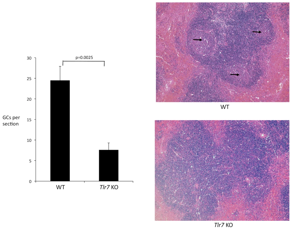 Histological analysis of germinal center formation during FV infection.