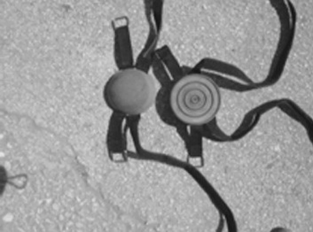Pomůcka balancestep.
