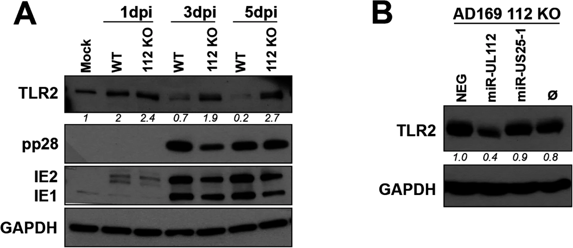 miR-UL112-3p targets endogenous TLR2 during HCMV infection.