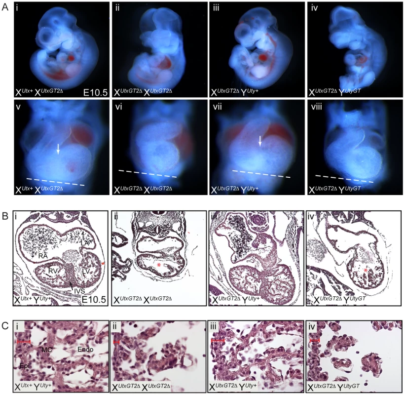 UTX and UTY redundancy is essential for progression of cardiac development.