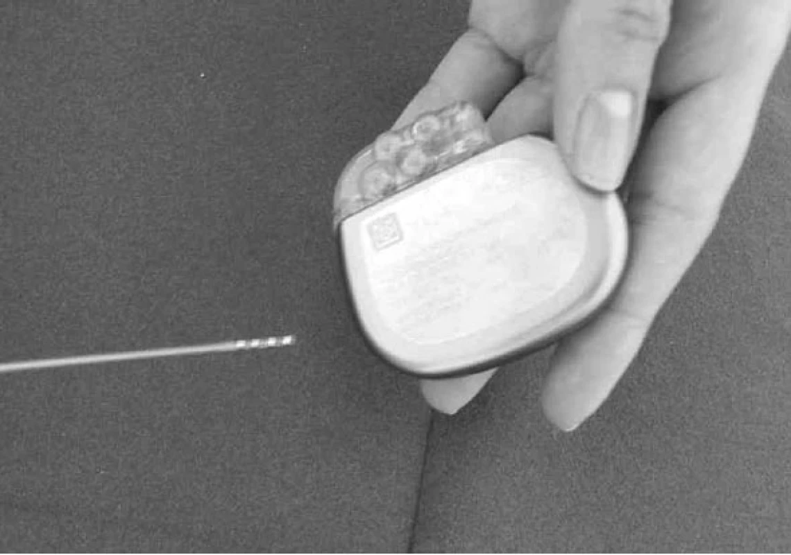 Intracerebrální stimulační elektroda a implantabilní neurostimulátor