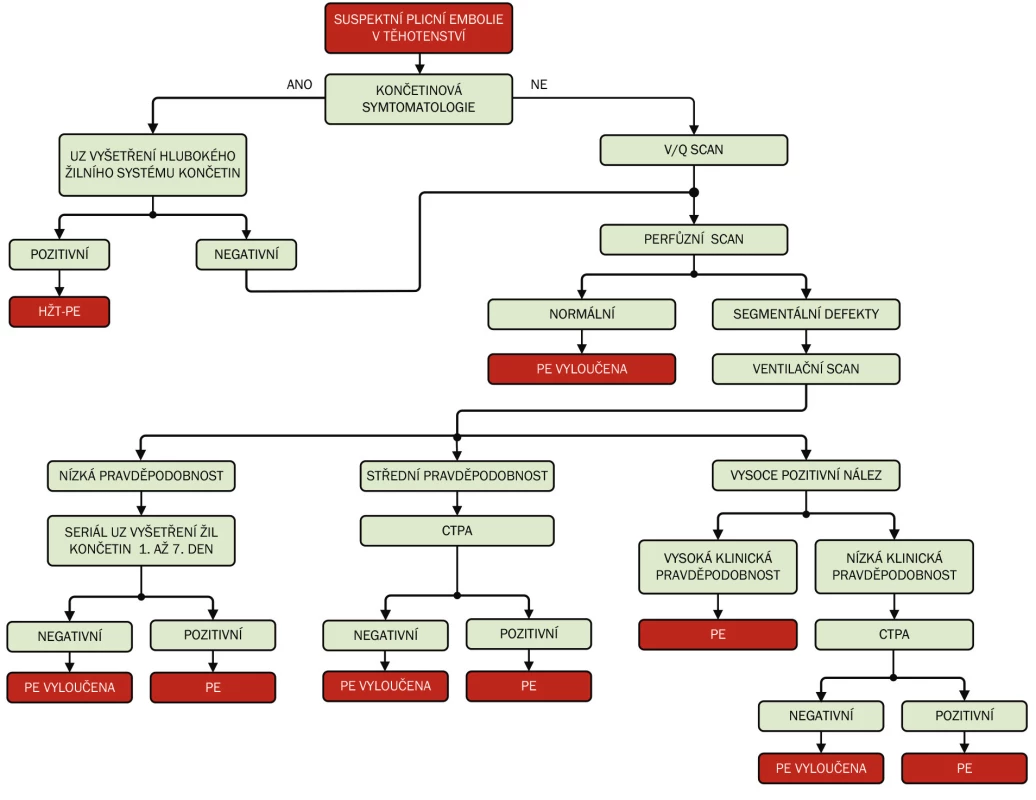 Diagnostika plicní embolie v těhotenství u hemodynamicky stabilní pacientky PE – plicní embolie, HŽT – hluboká žilní trombóza