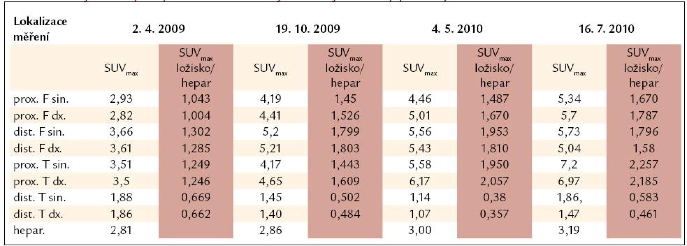 Výsledky vyšetření PET-CT vyjádřené jako hodnotou SUV<sub>max</sub>, tak indexem SUV<sub>max</sub> ložiska/SUV<sub>max</sub> hepar. Pro srovnání jednotlivých vyšetření mezi sebou je vhodnější uvedený poměrný index.