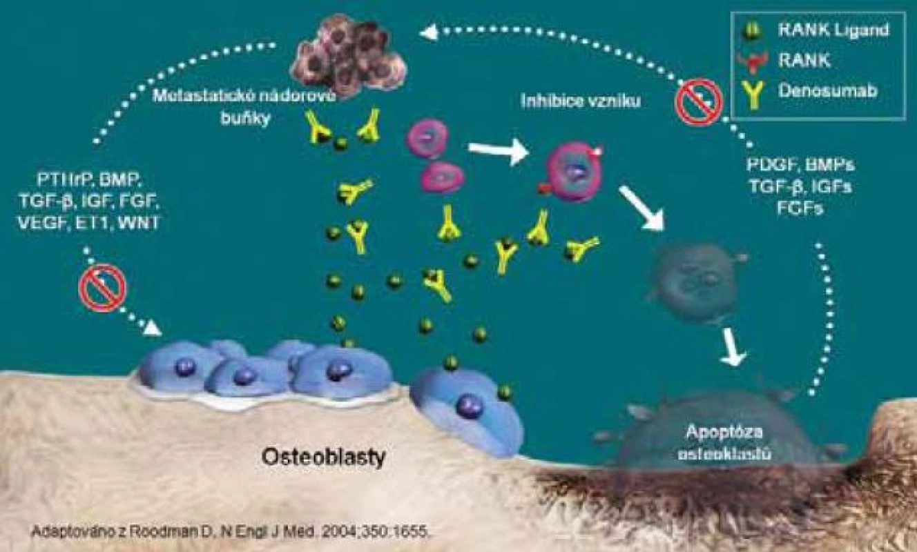 Denosumab může přerušit „začarovaný kruh“ kostní destrukce indukované nádorem.
