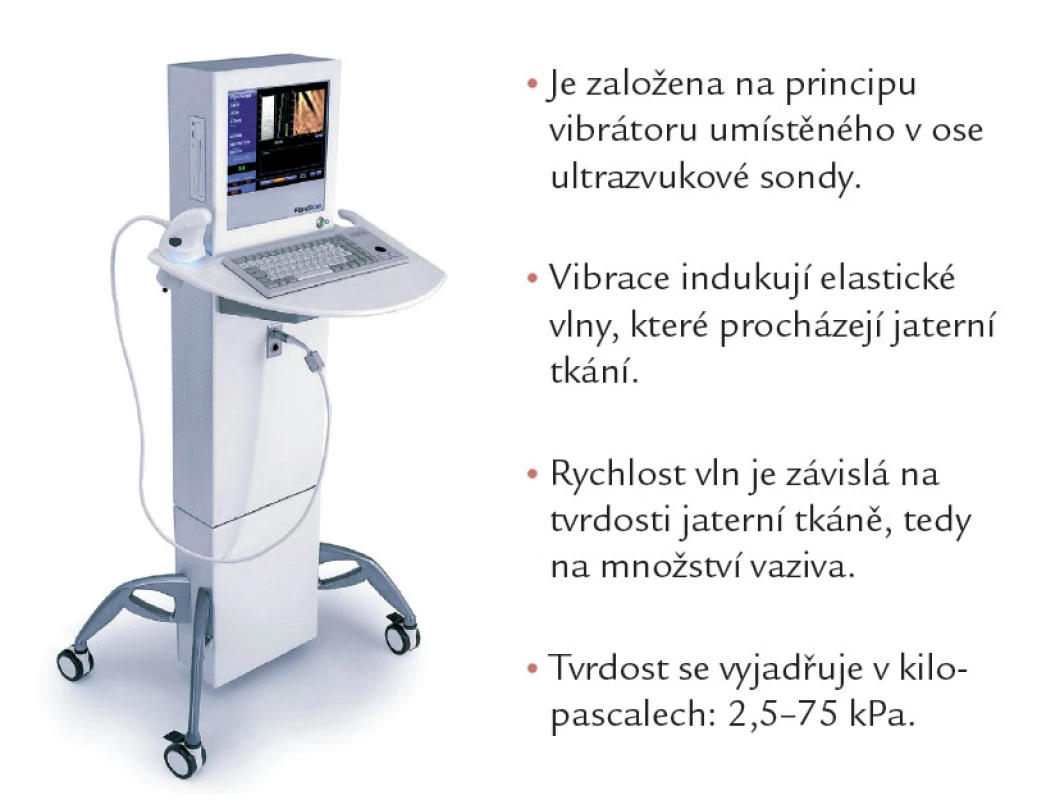 Fibroscan.