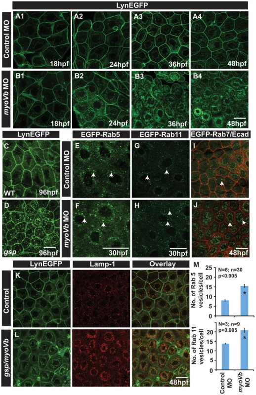 In absence of Myosin Vb, endosomes and lysosomes accumulate in the cytoplasm of peridermal cells.