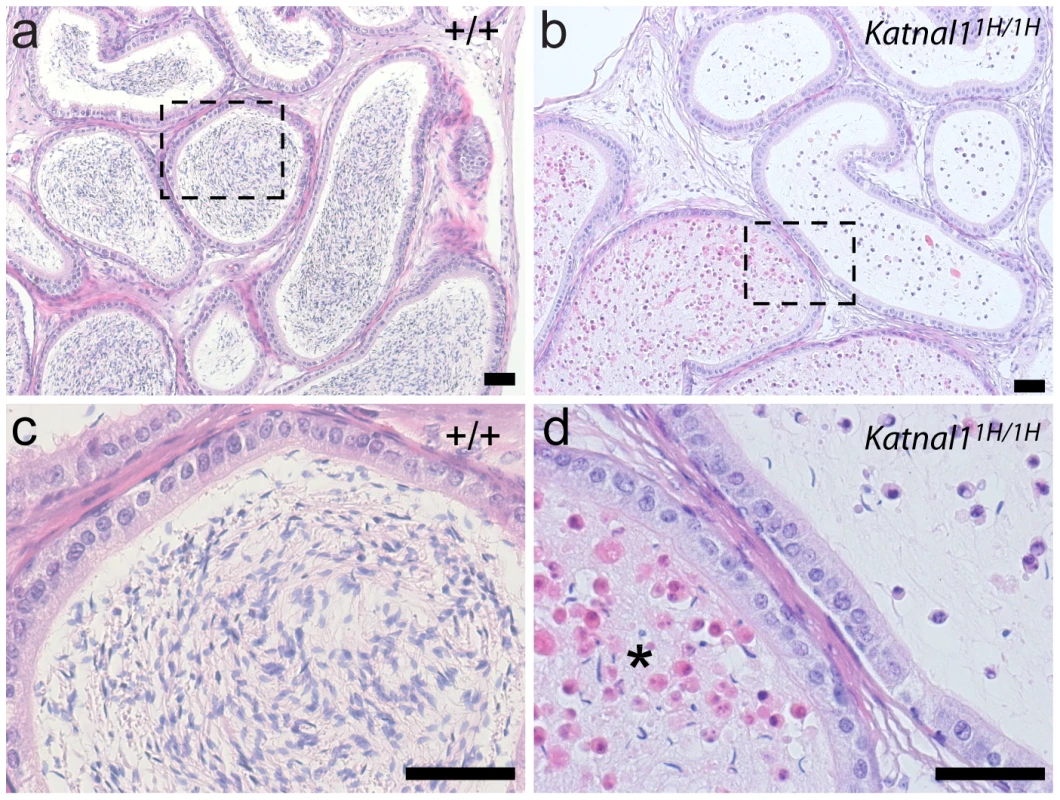 Reduction in post-meiotic germ cells is due to premature sloughing from the seminiferous epithelium.